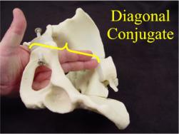 diagonal conjugate