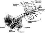 Cystoscopy