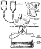 Foley Catheter Set Up