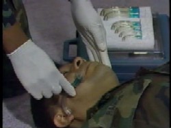 Insert an oropharyngeal airway