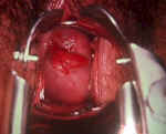 ecpolyp640.jpg (56131 bytes)